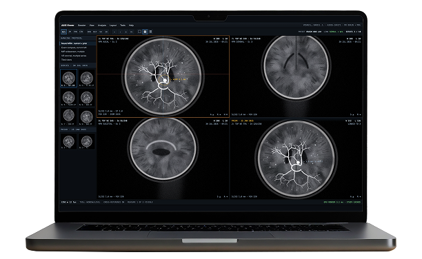 Medical Imaging Software Development Services by IT Craft