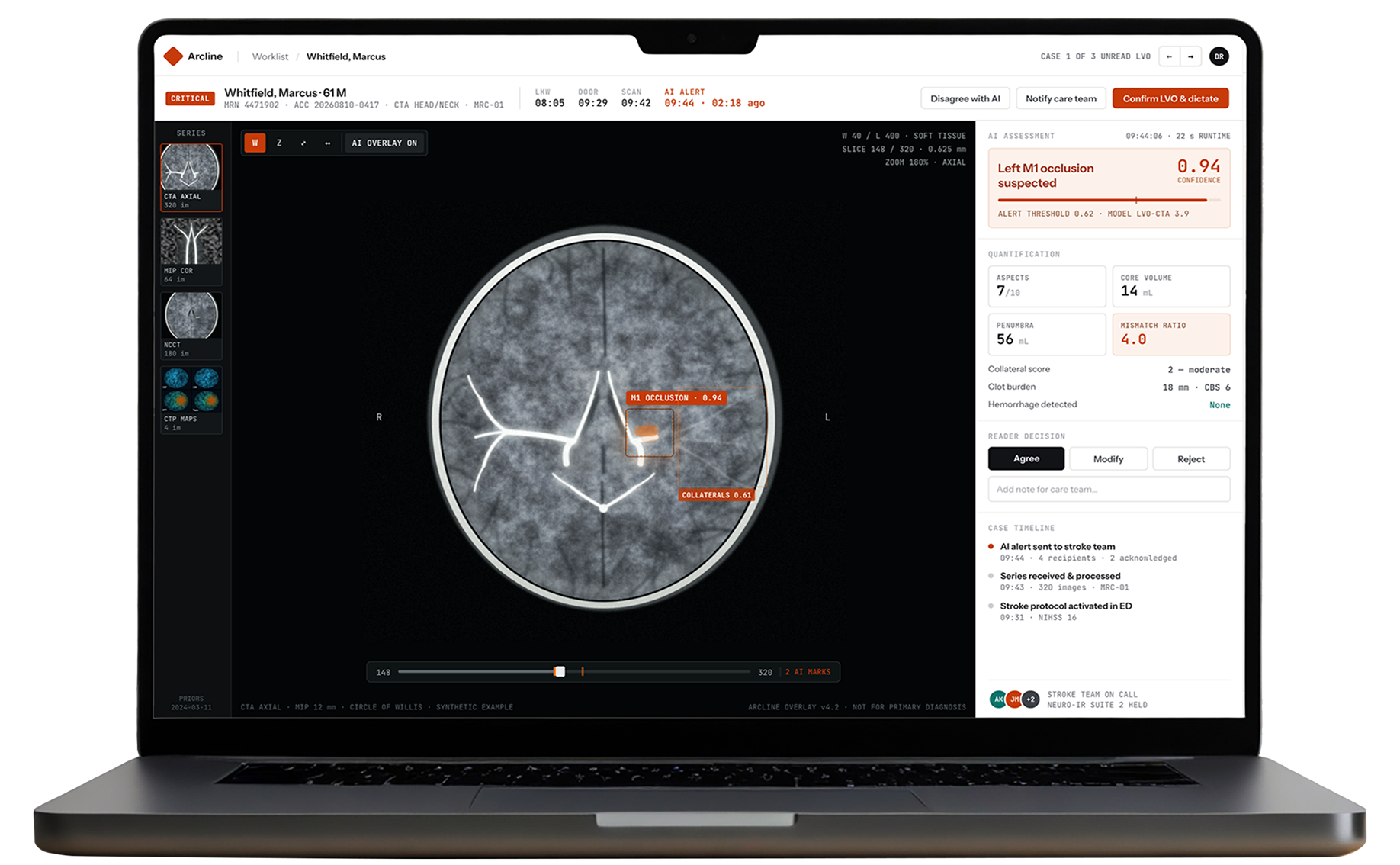 AI Medical Diagnosis Software Development by IT Craft
